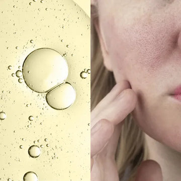 Forganica Skincare by Dr Faiza Shams pore minimizing treatment for open pores in Pakistan.