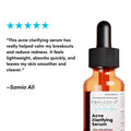 Customer feedback on Forganica Anti-Acne Serum for acne-prone skin, oil control, and visible skin improvement