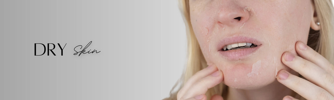 Forganica_Skincare_Dry_skin_banner_showing_flakiness_and_dehydration_representing_molecular_hydration_and_barrier-repair_skincare_solutions.