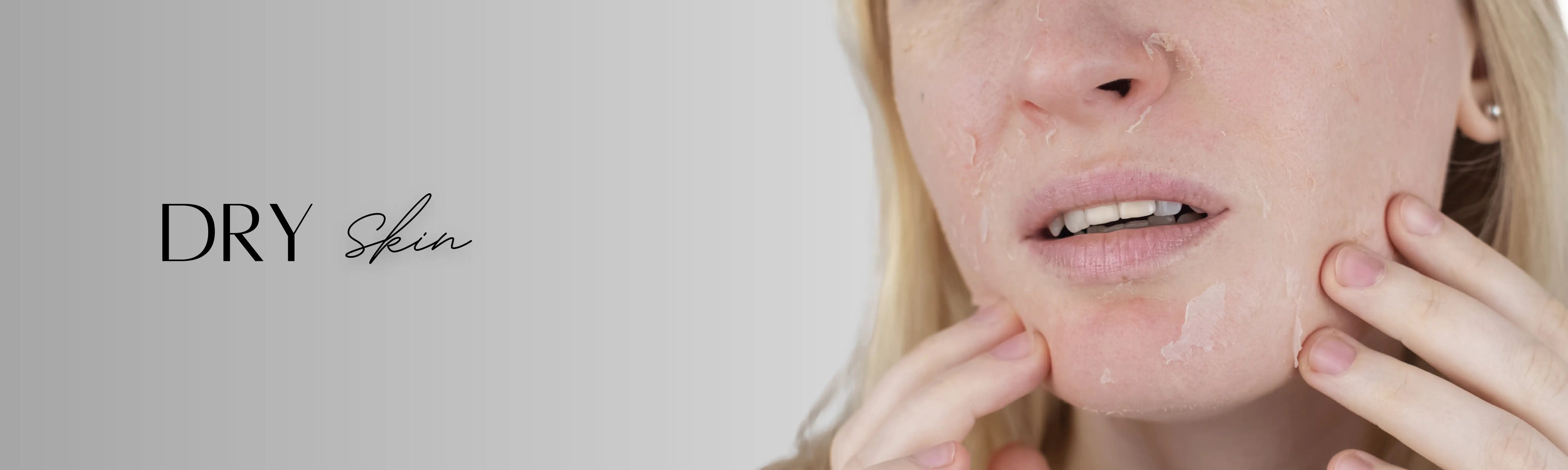 Forganica_Skincare_Dry_skin_banner_showing_flakiness_and_dehydration_representing_molecular_hydration_and_barrier-repair_skincare_solutions.