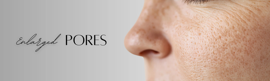 Forganica_Skincare_Enlarged_pores_banner_representing_niacinamide_and_zinc_PCA_molecular_treatment_for_pore_refinement.