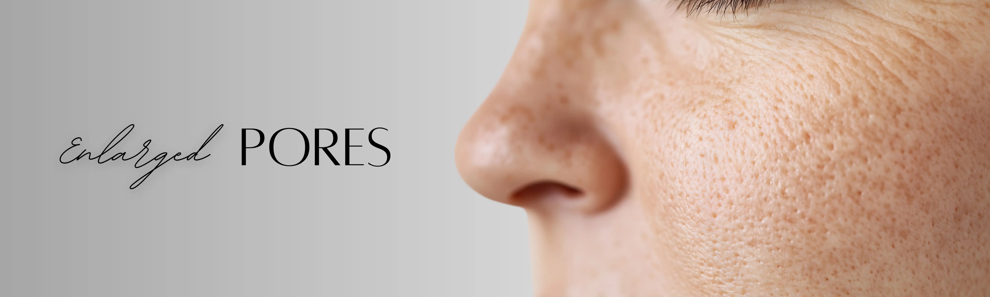 Forganica_Skincare_Enlarged_pores_banner_representing_niacinamide_and_zinc_PCA_molecular_treatment_for_pore_refinement.