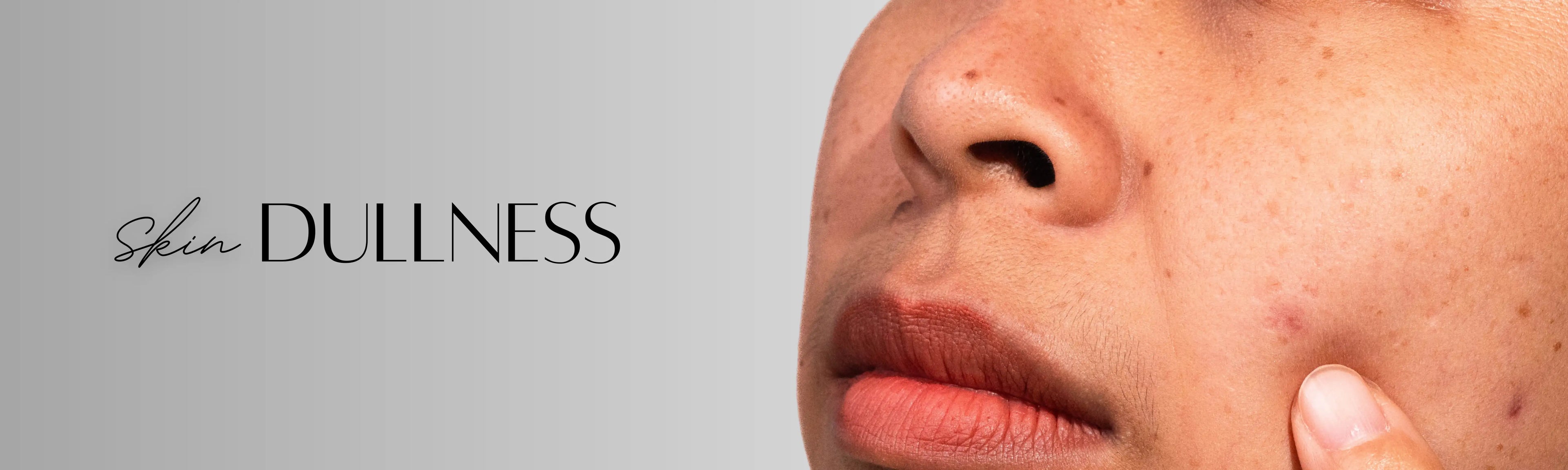 Forganica_Skincare_Skin_dullness_banner_showing_uneven_tone_and_lack_of_radiance_representing_molecular_skincare_solutions_for_brightening_and_glow.