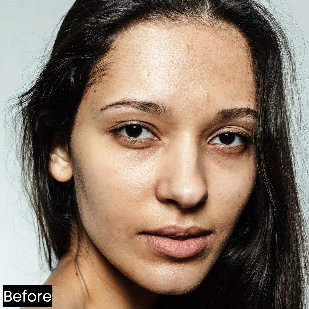 Forganica_sunscreen_girl_face_before_sunscreen