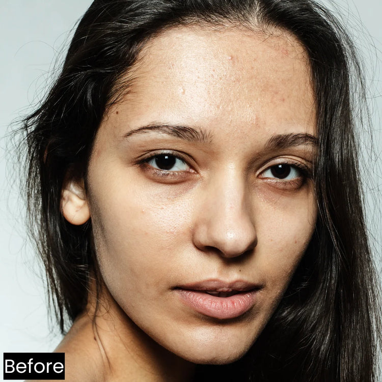 Forganica_sunscreen_girl_face_before_sunscreen