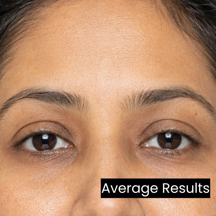 after_image_peptide_repair_serum-forganica_molecular_skincare