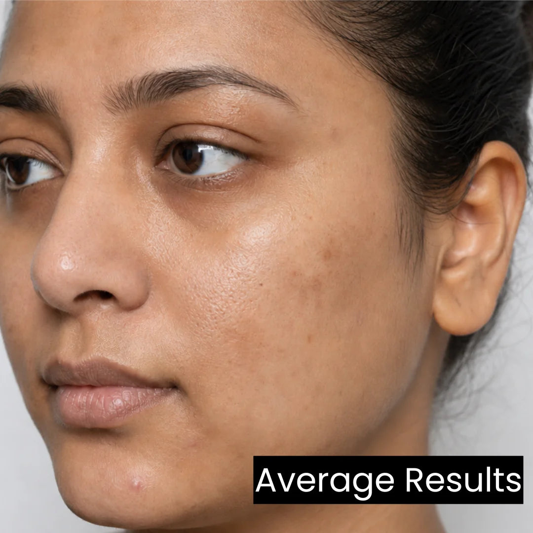 after_using_silymarin_antioxidant_serum-Forganica_molecular_skincare