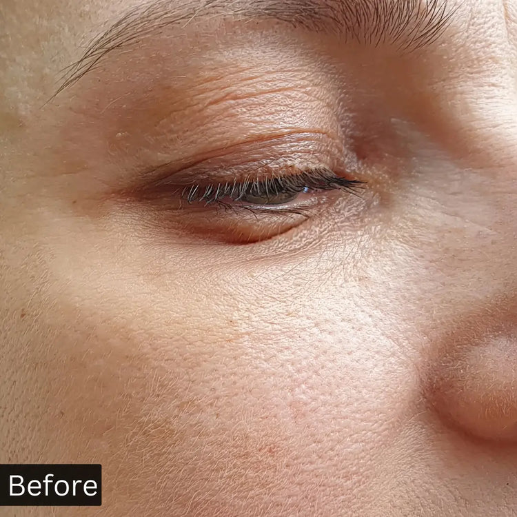 before using hyaluronic acid serum image