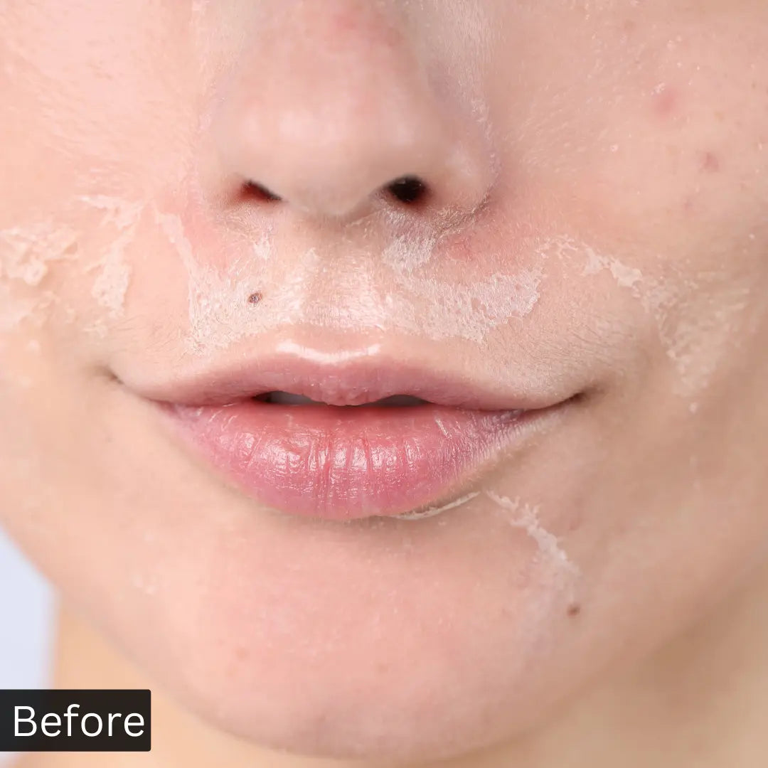 Dry skin before and after results using Forganica Hyaluronic Acid Serum for deep hydration and glowing skin
