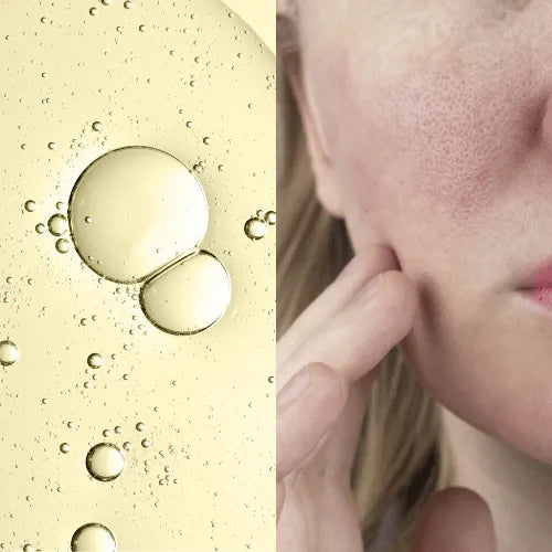 Forganica Skincare by Dr Faiza Shams pore minimizing treatment for open pores in Pakistan.